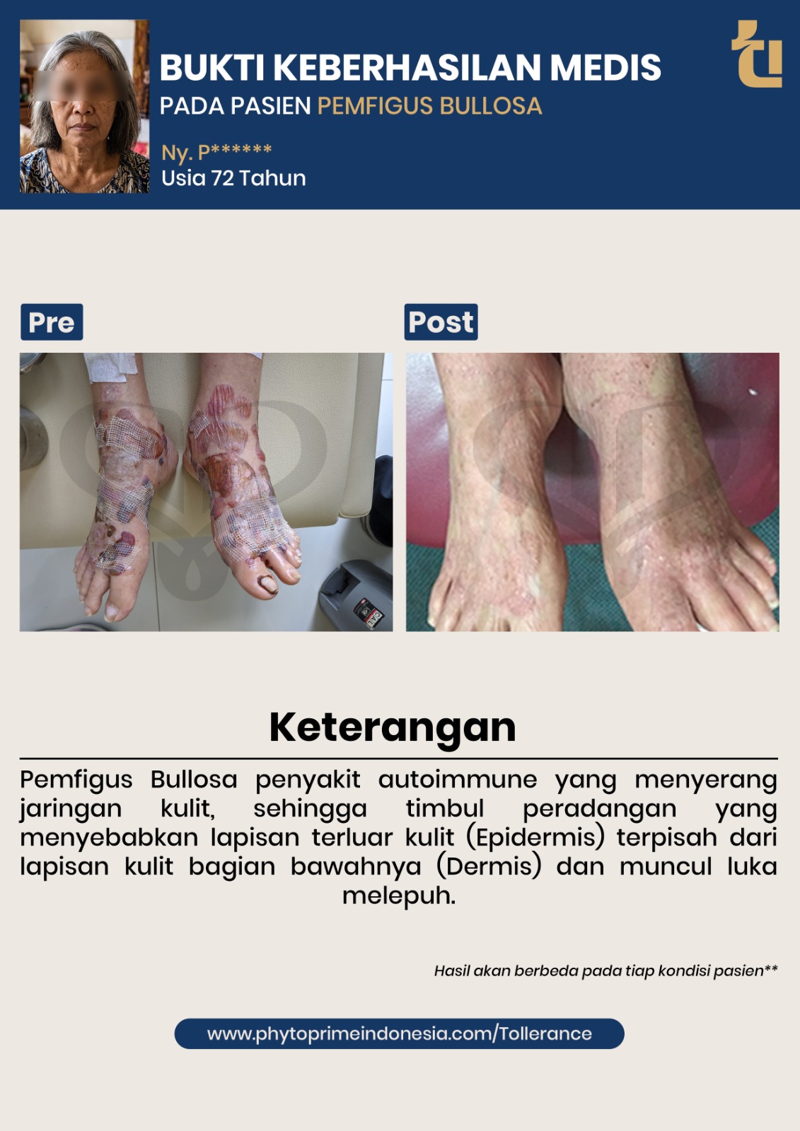 Bukti keberhasilan medis pasien kedua